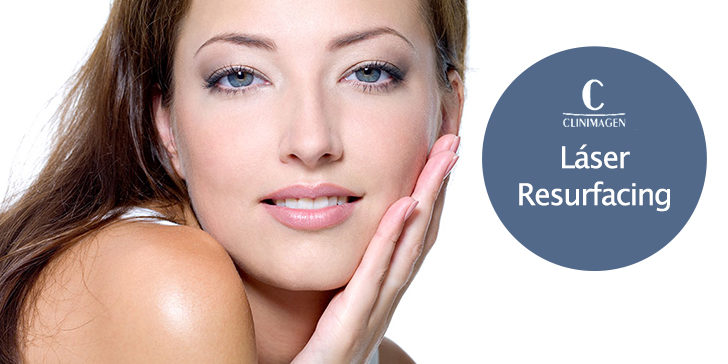 Láser Resurfacing, La solución para acabar con manchas, arrugas y envejecimiento facial