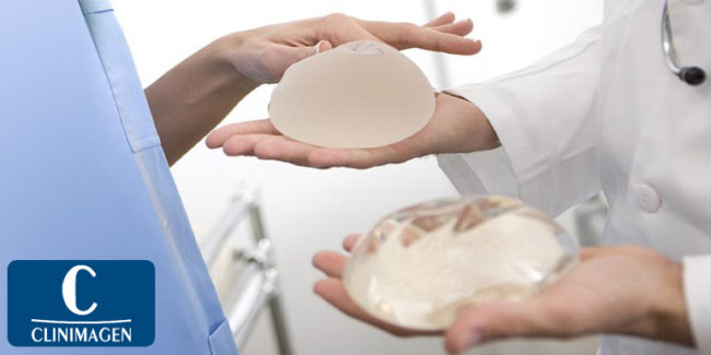 Prótesis mamarias para mamoplastia de aumento
