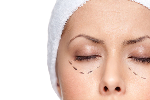 blefaroplastia