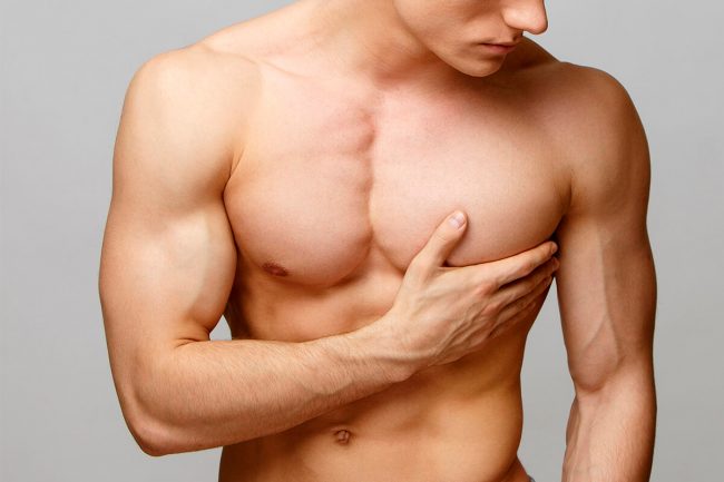 ginecomastia (1) ginecomastia