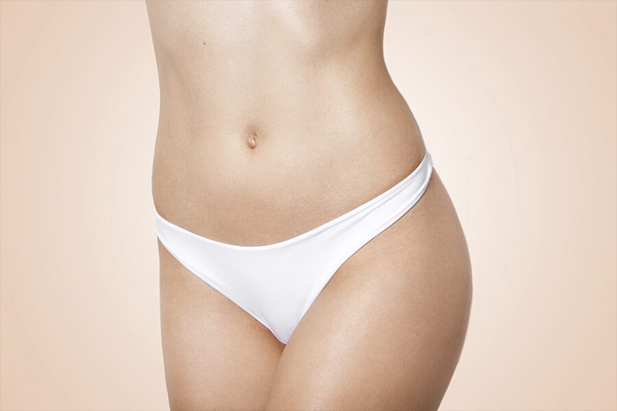 la abdominoplastia