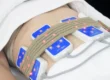 lipolaser