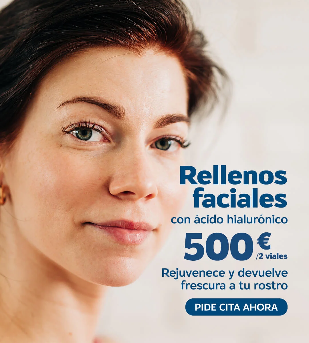 rellenos-faciales